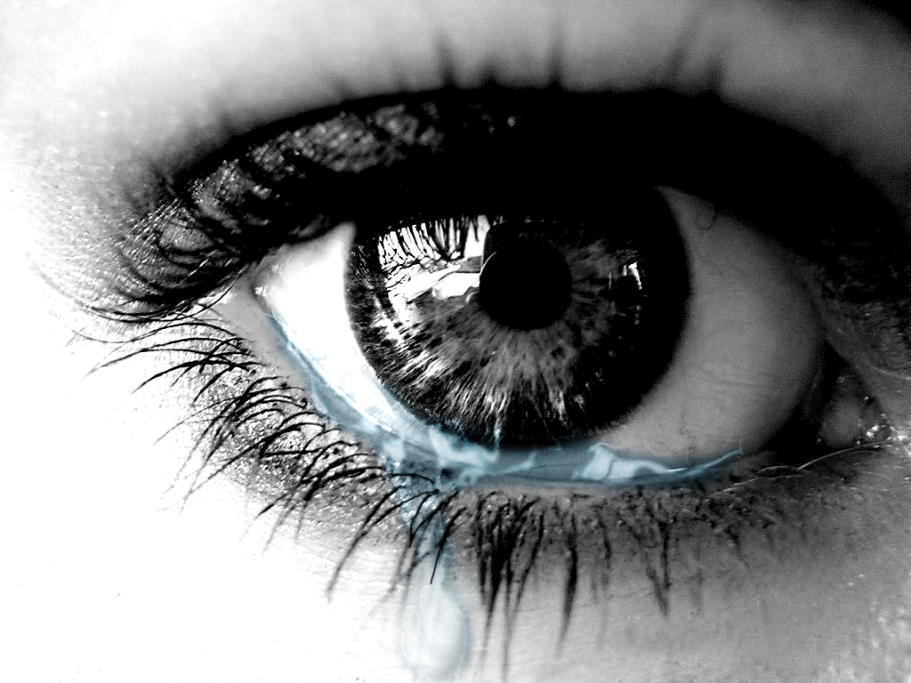Lágrimas em excesso | VisionCor